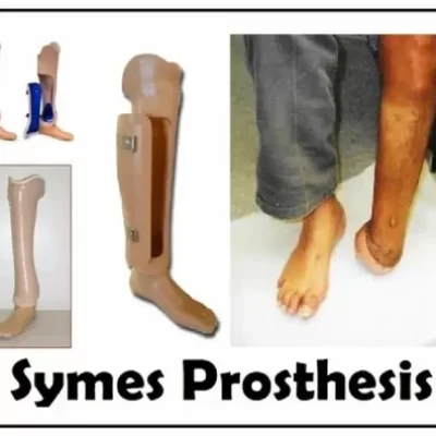 intell-symes-foot-500x500